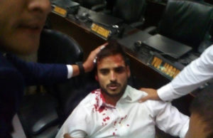 国会に侵入した大統領派に襲われ、負傷したベネズエラの議員もしくは国会職員と思われる人（Asamblea Nacional VE）