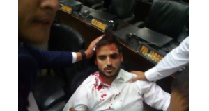 国会に侵入した大統領派に襲われ、負傷したベネズエラの議員もしくは国会職員と思われる人（Asamblea Nacional VE）